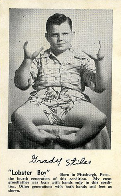 The original lobster boy, one of the carnival freaks who wintered in Gibsonton, Florida.
