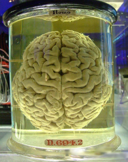 Brain in Formaldehyde